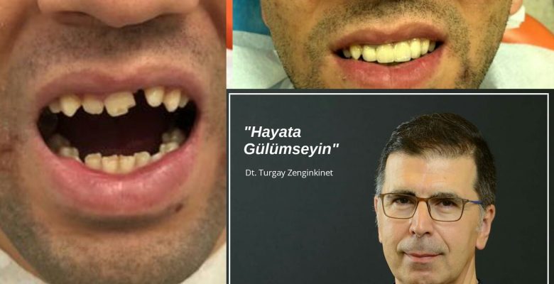 Hayata Gülümseyin, Teşekkürler Turgay Zenginkinet Hayata Gülümseyin, Teşekkürler Turgay Zenginkinet